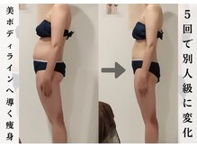 ビューティーグランツ(beauty granz)/５回でここまで変化！
