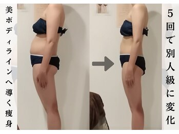 ビューティーグランツ(beauty granz)/５回でここまで変化！