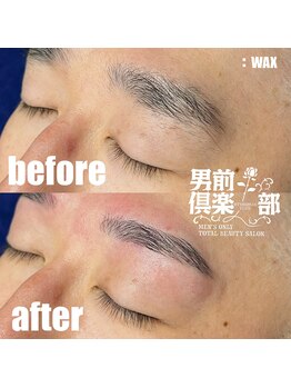 男前倶楽部/脱毛/メンズ脱毛/メンズ専門店