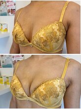 美人バスト 岡崎店/【バストアップ★育乳】症例