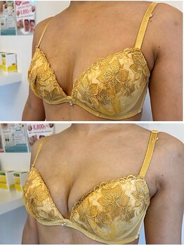 美人バスト 岡崎店/【バストアップ★育乳】症例