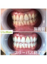 ルブラン 奈良店(Le Blanc)/太陽の下で1番映える！