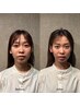 【エラはり・歪み特化】かいぼう学に基づく小顔矯正