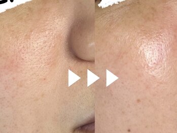 ベルード(veludo)/