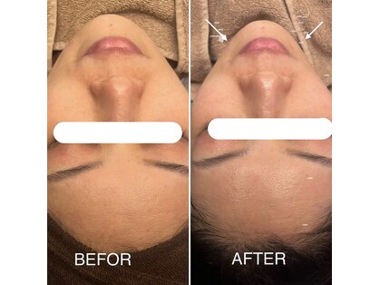 エミューズ(eMuse)の写真