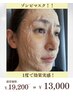 【リフトアップ】ゾンビマスクで年齢よりも若く見られる肌へ¥19,200→¥13,000