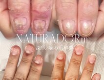 ナチュラドール(NATURADORm)