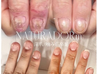 ナチュラドール(NATURADORm)の写真