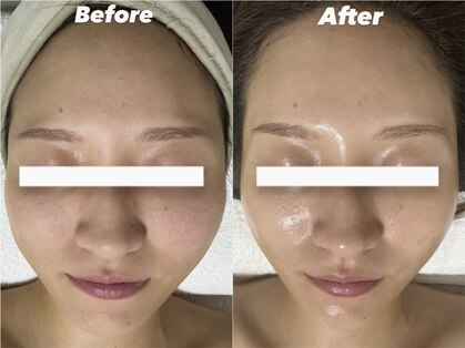 ルーナ 恵比寿(Luna)の写真