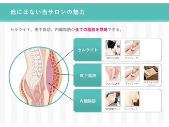 エステ シンセリティー(aesthetic sincerity)の写真/最先端マシンで理想のサイズダウン！寝てるだけで痩せる！体の疲れも癒やすエステダイエット☆