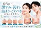 ビオナス 高田馬場店(BIONAS)の写真/【毛穴洗浄／フェイシャル】黒ずみ・角栓をすっきり洗浄×潤いケアでなめらか肌へ導くケア
