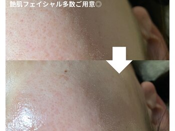 トータルビューティーサロンリア(Li'a)の写真/目指すは艶肌！毛穴ケア＆白玉美白で韓国肌管理。リフトケアでハリのある印象に♪