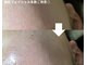 トータルビューティーサロンリア(Li'a)の写真/目指すは艶肌！毛穴ケア＆白玉美白で韓国肌管理。リフトケアでハリのある印象に♪