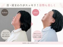 ヨサパーク アカーシャ(YOSA PARK AKASHA)/首が動く～♪