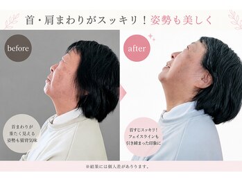 ヨサパーク アカーシャ(YOSA PARK AKASHA)/首が動く~♪