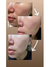 サロン ウイ(salon u'i)/～リブセラ～