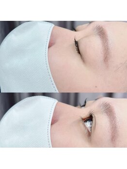 イチマルニ(102)/