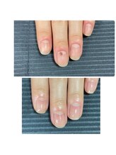 ウェルズユキ(well's yuki)/爪が短くてガタガタ