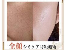 ココ(KOKO)/2度目からは入店～退店まで30分