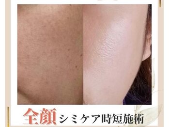 ココ(KOKO)/2度目からは入店~退店まで30分