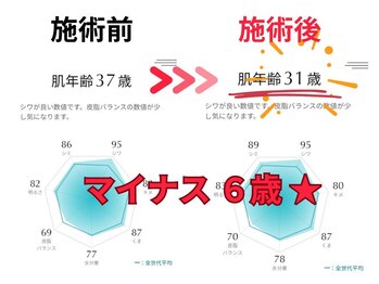 鍼灸整体ラクーナ/AI 肌年齢 診断