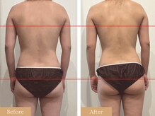 ラピスラズリ/ポールシェリー1回[痩身エステ]