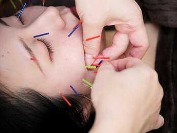 スポーツと小顔美容鍼のフジオカ鍼灸接骨院~肩こり・腰痛~の写真/【美容鍼でハリ感UP★内側から輝く素肌へ◎】血流促進&肌代謝をサポートし、フェイスラインを引き締め♪