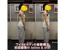 ワイルドボディ(WILD BODY)/姿勢矯正での改善例