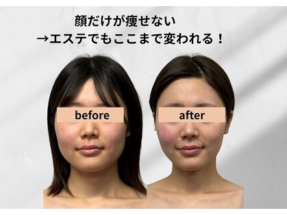 アールメディカルサロン 富山院(R Medical Salon)の写真