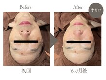 ビューティーリバース 相模大野店/★劇的ビフォーアフター★