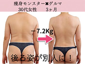 ファニービー 高槻店/症例写真