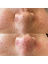 シグネット(Cygnet)/CHRISTINA/ビオフィート