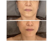 ジーニー(Genie)/フェイシャルと「整えヘッド」