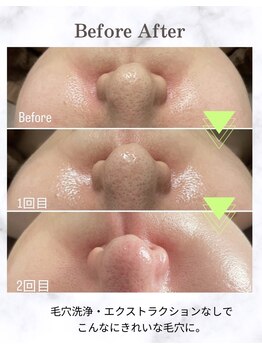 ポリー(Polly)/ラミネーション　before&after