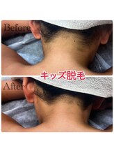 エヌアール(NR)/キッズ　うなじ