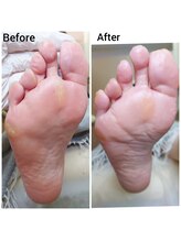 リゼラアンドコー 上越店/ドイツ式フットケア専門店