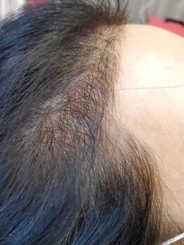 ココシア(CoCosia)の写真/話題のエクソソーム美容液を贅沢使用!熟練ハンドスパで頭皮環境を整え、ハリ・コシのある美髪へ導きます♪