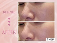 クリアラボ 池袋2nd(Clear Lab)/韓国肌管理&毛穴洗浄専門店