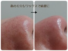 キナリ(kinari)の雰囲気（フェイシャルワックス脱毛は男性にも人気です♪毛穴スッキリ）