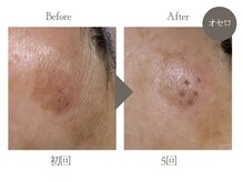 ビューティーリバース 相模大野店/★劇的ビフォーアフター★