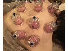 グリーンノート(GREEN NOTE)/カッピング