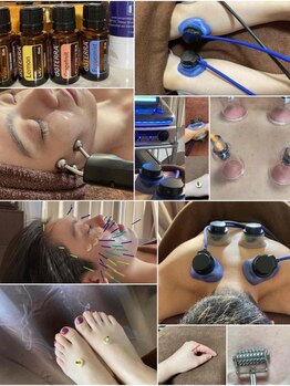 フェリーチェ鍼灸院の写真/【函館市】首や肩のコリ・重さ改善に!本格鍼灸で軽くなる身体を実感してください♪初めての方にもオススメ