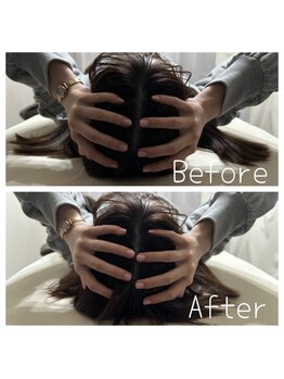 ルビー 新宿(Ruby)/頭から小顔に