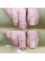 リゼラアンドコー 表参道店&nbsp;ドイツ式フットケア/フットキュア/フットケア/爪カット/甘皮ケア