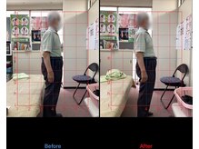 高芝鍼灸整骨院/猫背矯正