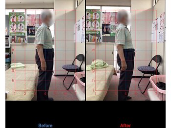 高芝鍼灸整骨院/猫背矯正