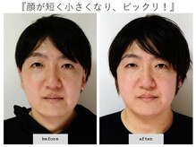 エピファニー(Epiphany)/30代　結婚式直前妻に…