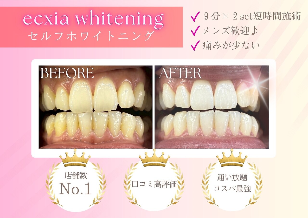 歯のセルフホワイトニング サロンでのセルフホワイトニングでは、歯は白くならない！？ | 山梨県