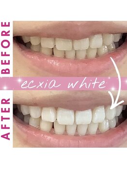 エクシアホワイト 長野店/