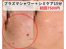 ベルファーム(Belle Femme)の雰囲気（プラズマシャワー＋シミケア15分初回7500円☆）